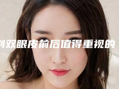 割双眼皮前后值得重视的点(割双眼皮的优点)